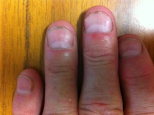 Stop Biting Finger Nails